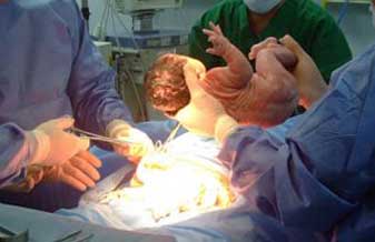 Carlos Gilberto Crippa - Foto 1